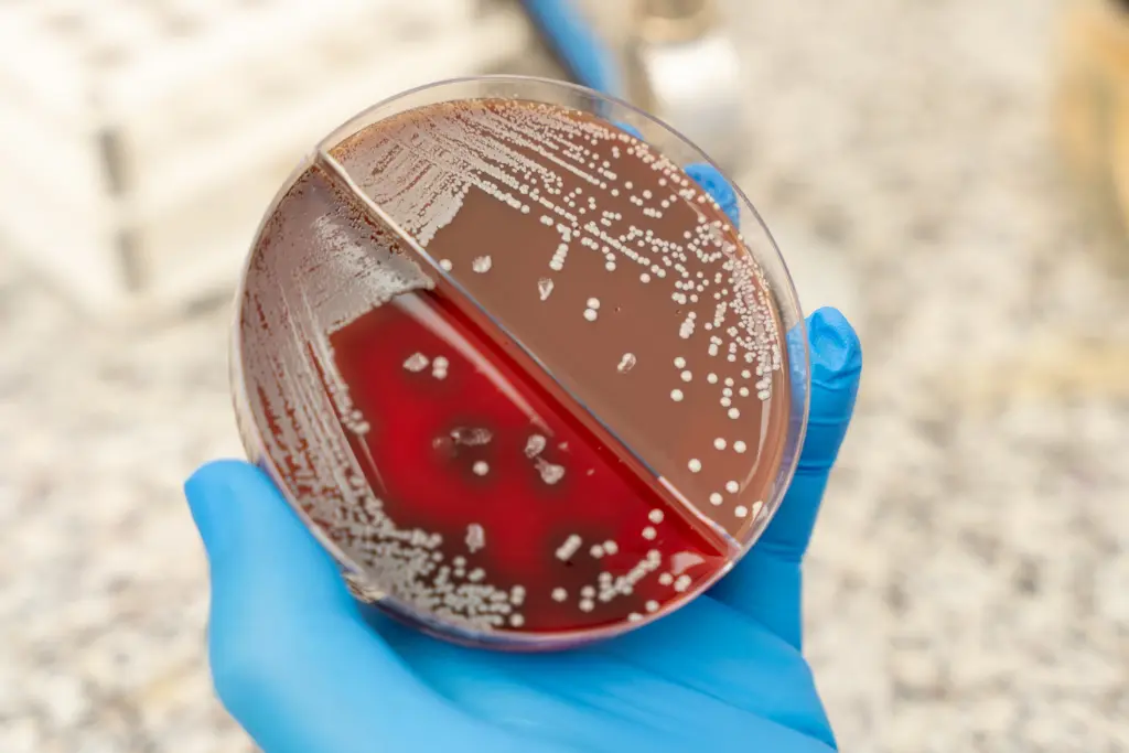 microbiología laboratorio clinico cabrera